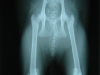 lucy-xray-before.jpg