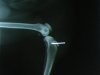 lucy-xray-pin-left.jpg