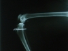 lucy-xray-pin-right.jpg
